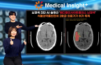 SK C&C wins Korea’s nod for brain infarct diagnosis AI solution